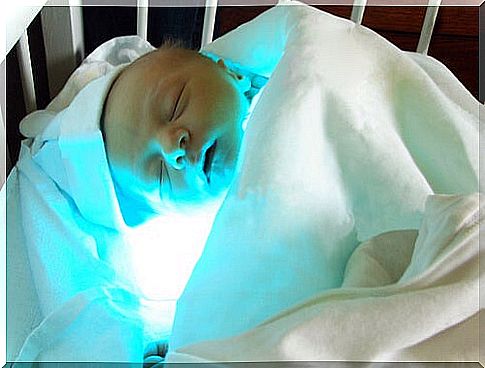 Infantile jaundice: what it is and how it manifests itself