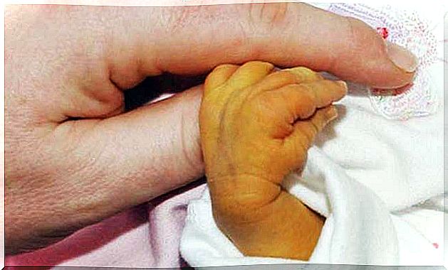 Newborn with infantile jaundice