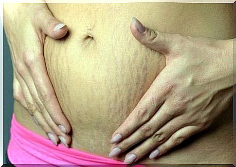 Is a pregnancy that leaves no marks possible?